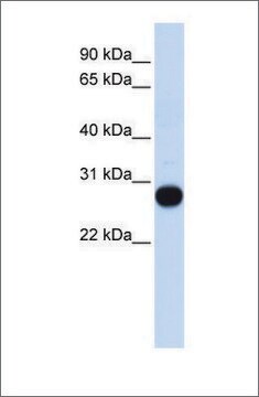 Anti-TCEAL4 antibody produced in rabbit affinity isolated antibody