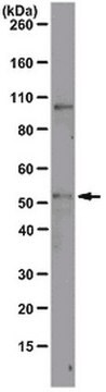 Anti-ODC1 Antibody, clone CPTC-ODC1-2 clone CPTC-ODC1-2, from mouse