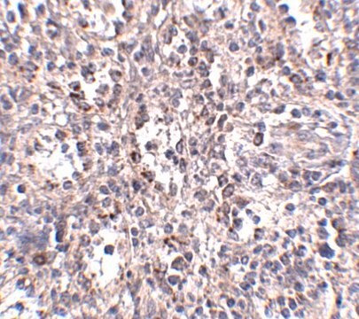 Anti-SCARB1 antibody produced in rabbit affinity isolated antibody