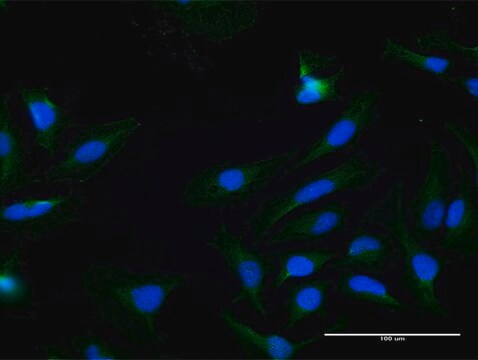 Anti-KLK7 antibody produced in mouse purified immunoglobulin, buffered aqueous solution