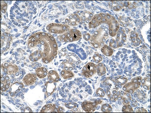 Anti-XTP3TPA (AB1) antibody produced in rabbit affinity isolated antibody