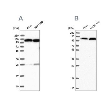 Anti-AARS antibody produced in rabbit Prestige Antibodies&#174; Powered by Atlas Antibodies, affinity isolated antibody, buffered aqueous glycerol solution