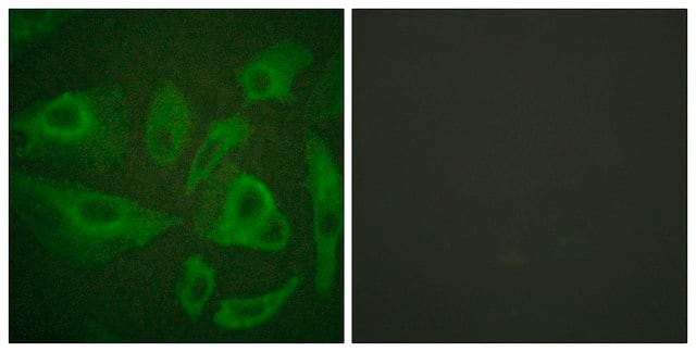 Anti-FAS antibody produced in rabbit affinity isolated antibody