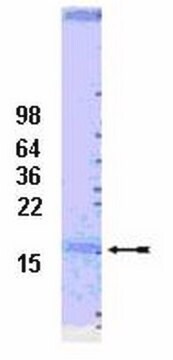 UbcH7 Conjugating Enzyme, 100 &#181;g UbcH7 is a class I enzyme which functions in the stress response &amp; the control of transcription factors. The enzyme is ubiquitously expressed with high levels of expression seen in adult muscle.