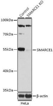 Anti-SMARCE1 antibody produced in rabbit