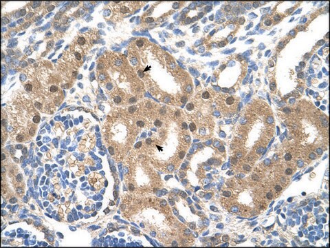 Anti-SLC39A6 antibody produced in rabbit IgG fraction of antiserum