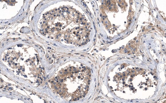 Anti-VE-Cadherin Antibody, clone 1O12 ZooMAb&#174; Rabbit Monoclonal recombinant, expressed in HEK 293 cells