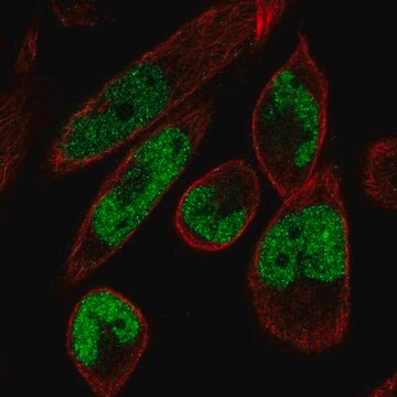 Anti-MAMLD1 antibody produced in rabbit Prestige Antibodies&#174; Powered by Atlas Antibodies, affinity isolated antibody, buffered aqueous glycerol solution