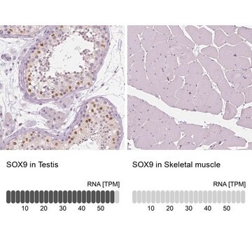 Anti-SOX9 antibody produced in rabbit Prestige Antibodies&#174; Powered by Atlas Antibodies, affinity isolated antibody, buffered aqueous glycerol solution