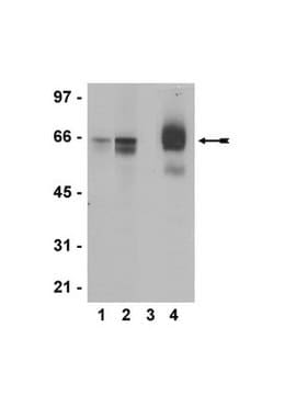 Anti-phospho-Estrogen Receptor alpha (Ser118) Antibody, clone NL44, rabbit monoclonal clone NL44, Upstate&#174;, from rabbit