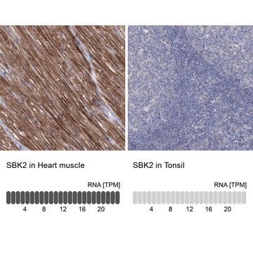 Anti-SBK2 antibody produced in rabbit Prestige Antibodies&#174; Powered by Atlas Antibodies, affinity isolated antibody, buffered aqueous glycerol solution