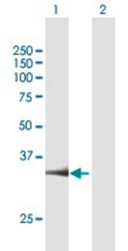 Anti-PARP16 antibody produced in mouse purified immunoglobulin, buffered aqueous solution