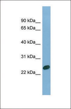 Anti-CHMP1B, (N-terminal) antibody produced in rabbit affinity isolated antibody