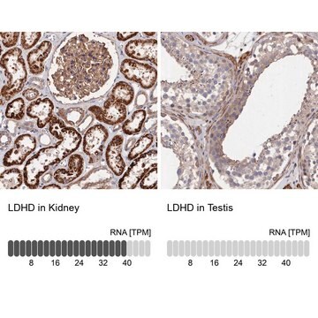 Anti-LDHD antibody produced in rabbit Prestige Antibodies&#174; Powered by Atlas Antibodies, affinity isolated antibody, buffered aqueous glycerol solution