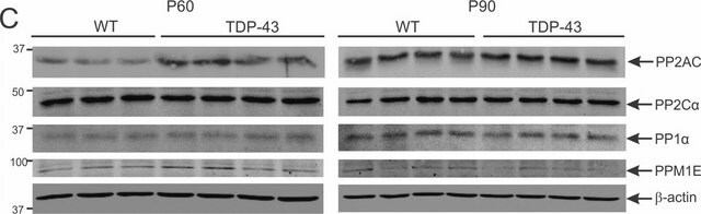 Anti-PP2A Antibody, C subunit, clone 1D6 clone 1D6, Upstate&#174;, from mouse