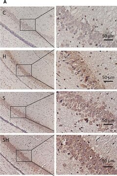 Anti-Neuroglobin antibody produced in rabbit ~1.2&#160;mg/mL, affinity isolated antibody, buffered aqueous solution