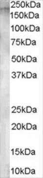 Anti-Aminopeptidase A antibody produced in goat affinity isolated antibody, buffered aqueous solution