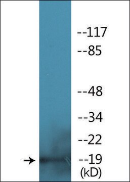 Anti-phospho-Myosin regulatory light chain 2 (pSer18) antibody produced in rabbit affinity isolated antibody