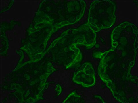 Monoclonal Anti-Cytokeratin Peptide 8 antibody produced in mouse clone M20, ascites fluid