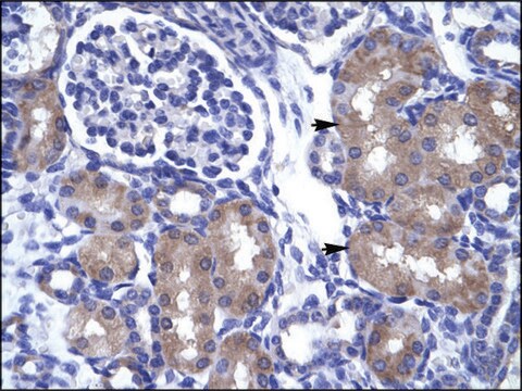 Anti-ASCL1 IgG fraction of antiserum