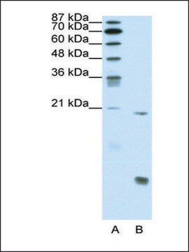 Anti-RUNX1 antibody produced in rabbit affinity isolated antibody