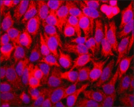 Anti-STUB1/CHIP antibody, mouse monoclonal clone ST21.55, purified from hybridoma cell culture