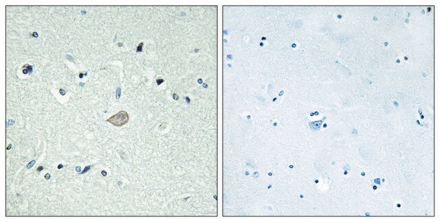 Anti-BAI3 antibody produced in rabbit affinity isolated antibody