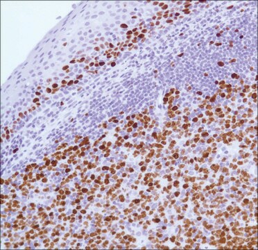 Anti-KI-67 antibody, Rabbit monoclonal recombinant, expressed in proprietary host, clone SP6, tissue culture supernatant