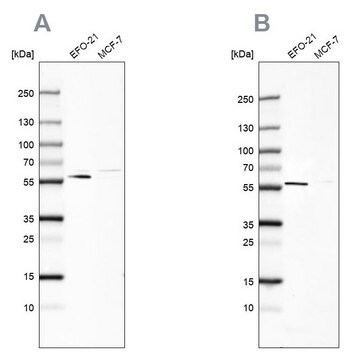 Anti-PDP1 antibody produced in rabbit Prestige Antibodies&#174; Powered by Atlas Antibodies, affinity isolated antibody, buffered aqueous glycerol solution