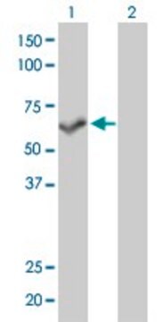 Monoclonal Anti-PPP3CB antibody produced in mouse clone 5D3, purified immunoglobulin, buffered aqueous solution