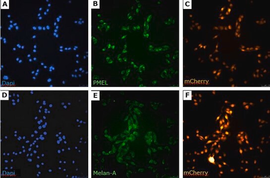 sBT-RMS Spontaneous Brain-tropic RET Melanoma-sorted Mouse Cell Line