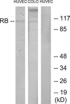 Anti-Retinoblastoma antibody produced in rabbit affinity isolated antibody