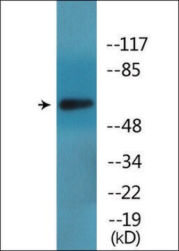 Anti-phospho-ICAM-1 (pTyr512) antibody produced in rabbit affinity isolated antibody