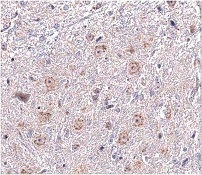 Anti-SAPAP3 Antibody from rabbit, purified by affinity chromatography