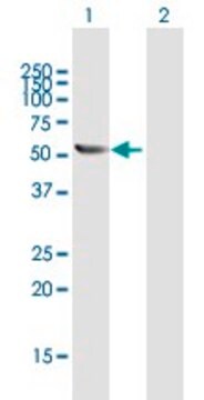 Anti-TBCE antibody produced in rabbit purified immunoglobulin, buffered aqueous solution