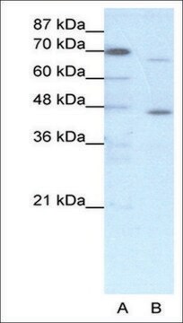 Anti-ESR2 antibody produced in rabbit affinity isolated antibody