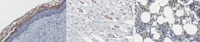 Anti-Kallikrein 7/KLK7 Antibody, clone 73-1 clone 73-1, from mouse