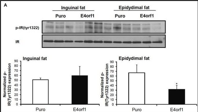 Anti-phospho-Insulin Receptor (Tyr 1322) Antibody, clone 21G12 clone 21g12, Upstate&#174;, from mouse