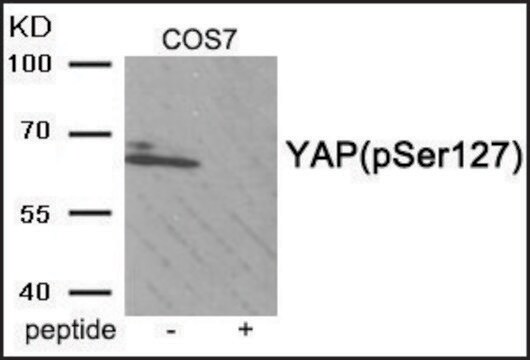 Anti-phospho-YAP (pSer127) antibody produced in rabbit affinity isolated antibody