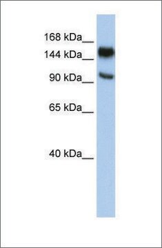 Anti-PARP10 antibody produced in rabbit affinity isolated antibody