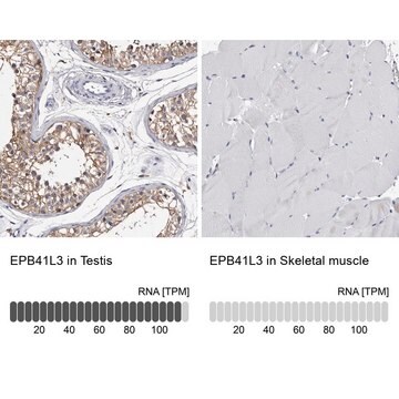 Anti-EPB41L3 antibody produced in rabbit Prestige Antibodies&#174; Powered by Atlas Antibodies, affinity isolated antibody, buffered aqueous glycerol solution