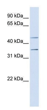 Anti-P2RY1 (N-terminal) antibody produced in rabbit affinity isolated antibody