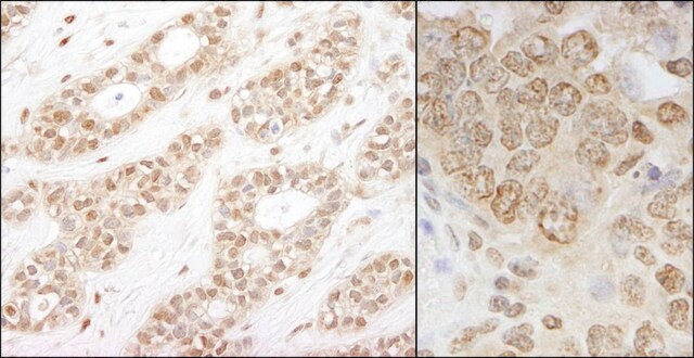 Rabbit anti-IKK-alpha Antibody, Affinity Purified Powered by Bethyl Laboratories, Inc.