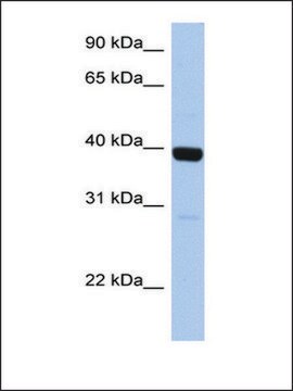 Anti-ZNF385B antibody produced in rabbit affinity isolated antibody