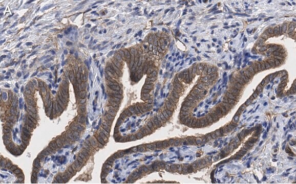 Anti-PKC&#953; Antibody, clone 1J13 ZooMAb&#174; Rabbit Monoclonal recombinant, expressed in HEK 293 cells