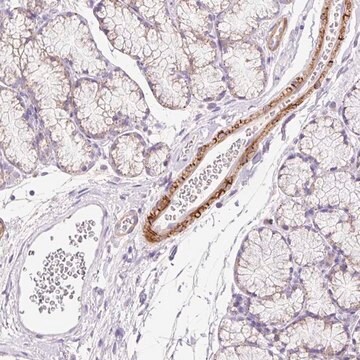 Anti-SUSD5 antibody produced in rabbit Prestige Antibodies&#174; Powered by Atlas Antibodies, affinity isolated antibody, buffered aqueous glycerol solution