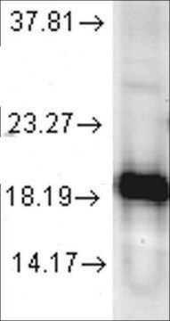 Anti-SOD1 antibody produced in rabbit 1&#160;mg/mL, affinity isolated antibody