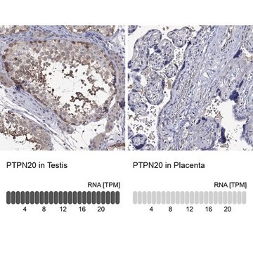 Anti-PTPN20 antibody produced in rabbit Prestige Antibodies&#174; Powered by Atlas Antibodies, affinity isolated antibody, buffered aqueous glycerol solution