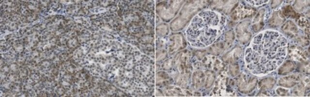 Anti-PHF1 from rabbit, purified by affinity chromatography