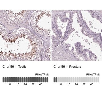 Anti-C1orf56 antibody produced in rabbit Prestige Antibodies&#174; Powered by Atlas Antibodies, affinity isolated antibody, buffered aqueous glycerol solution